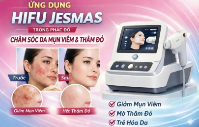 Ứng Dụng HIFU Jesmas Trong Phác Đồ Chăm Sóc Da Mụn Viêm Và Thâm Đỏ